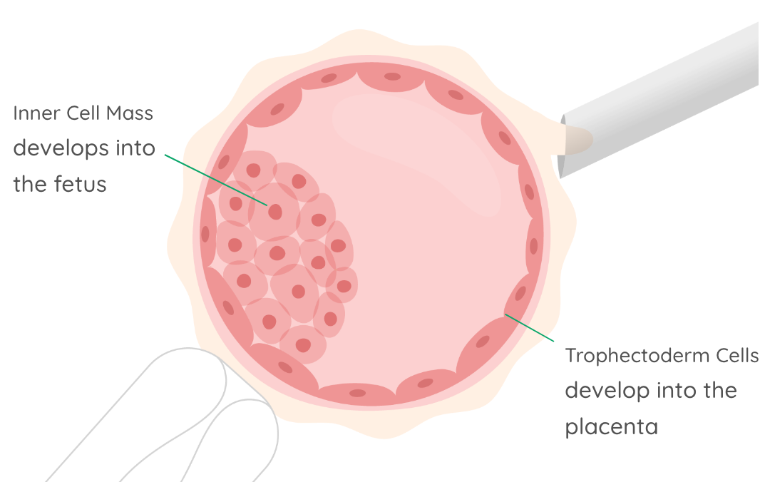 Embryo Biopsy—The First Step in Genetic Screening