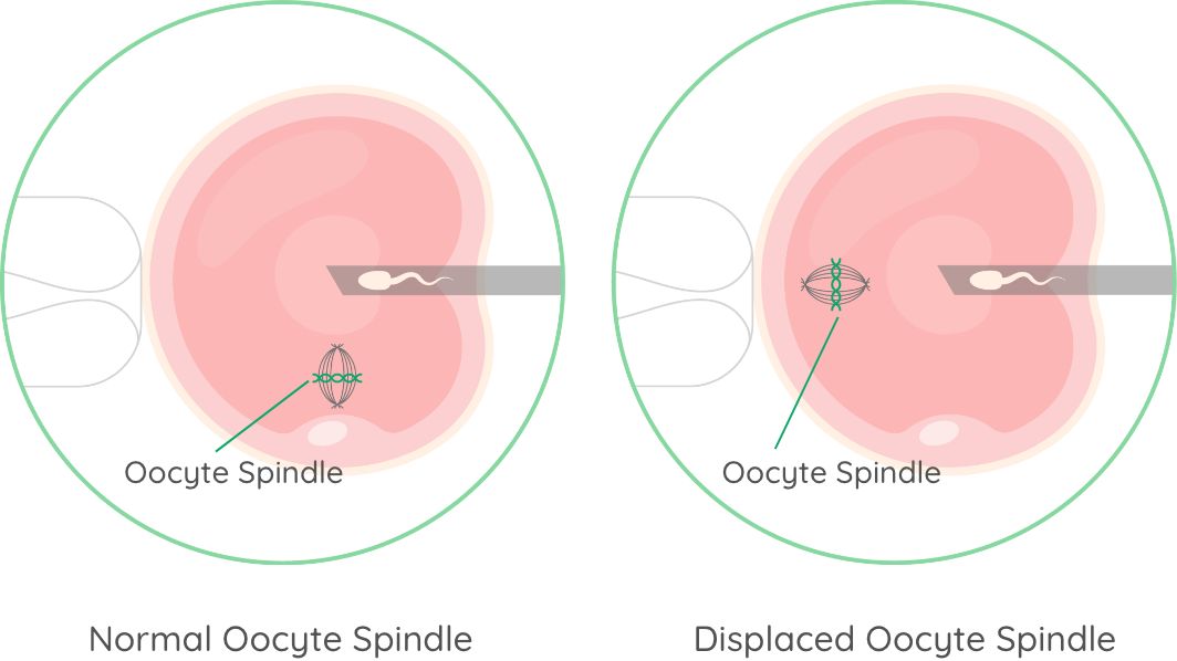 Visual Aid