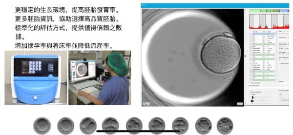 Time-Lapse Embryo Monitoring Culture System