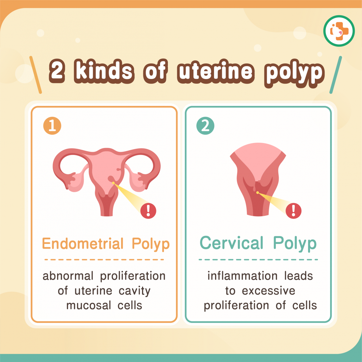 Types of uterine polyps Types of uterine polyps